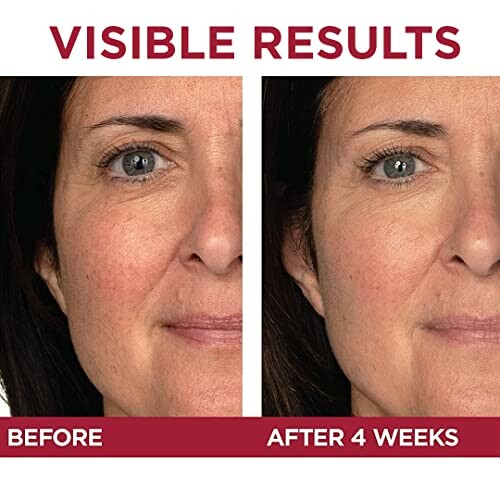 Before and after skincare results showing improved skin texture in four weeks.